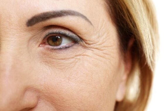 Do Creams Really Reduce Wrinkles? Ask the Experts